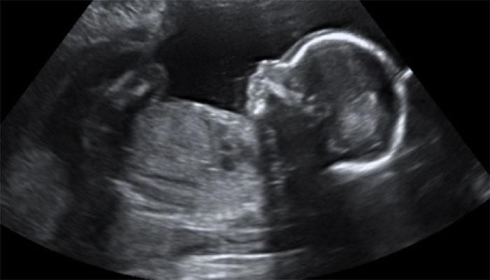 Obstetric Ultrasound Bozeman MT Obstetric Ultrasound Bozeman MT